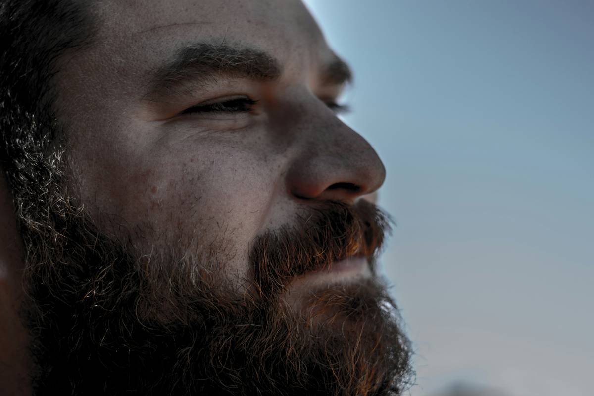 Infographic showing causes of dry skin under beards: sebum disruption, environmental factors, poor hygiene, and incorrect product use