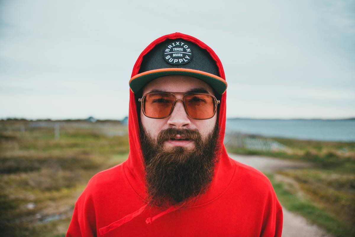 Infographic showing causes of dry flaky beard skin: harsh cleansers stripping natural oils, low humidity, irritating essential oils, and lack of moisturizing ingredients.